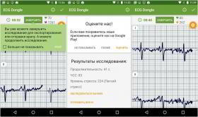 Обзор "кардиофлешки" ECG Dongle: сердечный контроль