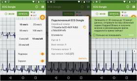 Обзор "кардиофлешки" ECG Dongle: сердечный контроль