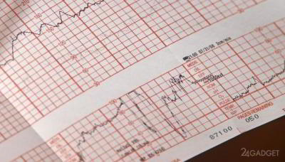 Аутентификация пользователей по ЭКГ? Учёные утверждают, что это возможно