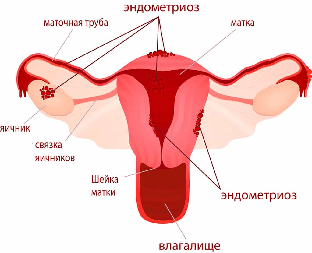 Что такое эндометрий?